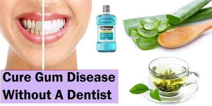 How to cure gum disease without a dentist